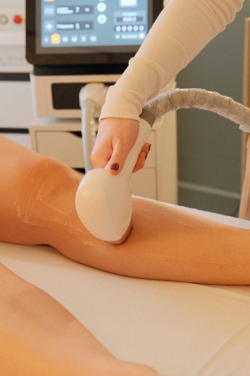 epilation laser dijon